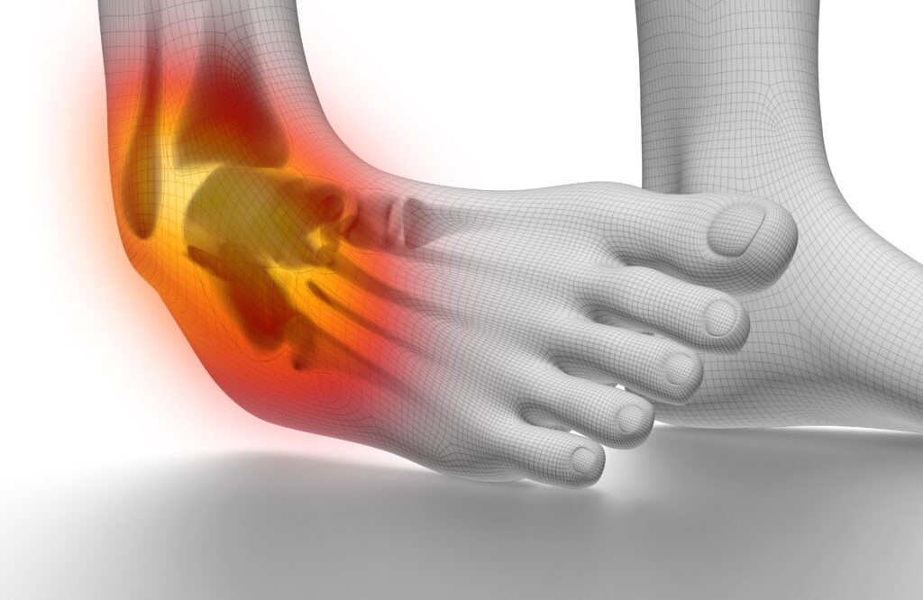 Ankle Sprain Treatment in Balewadi
