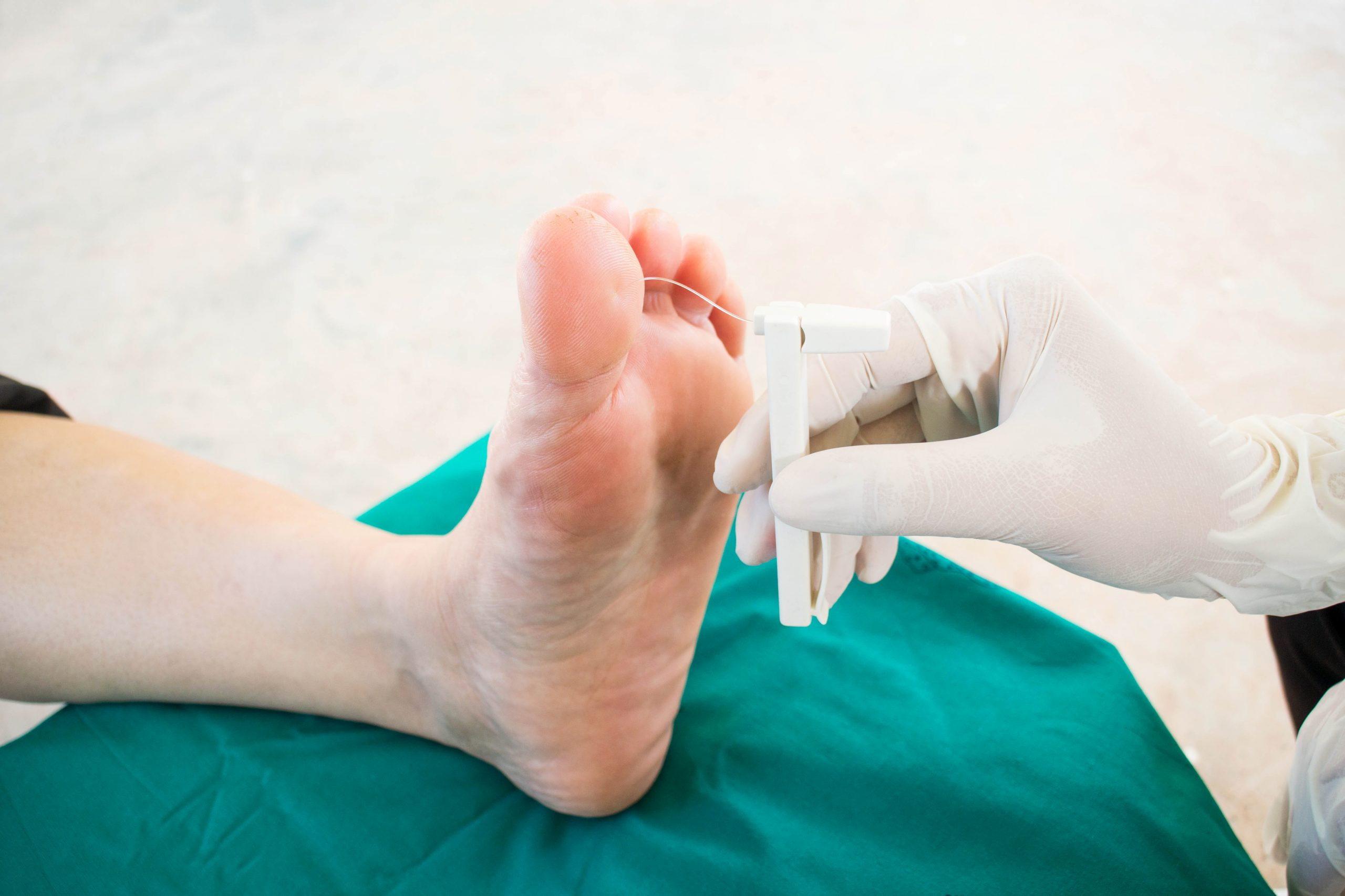Diabetic Foot Management in Aundh