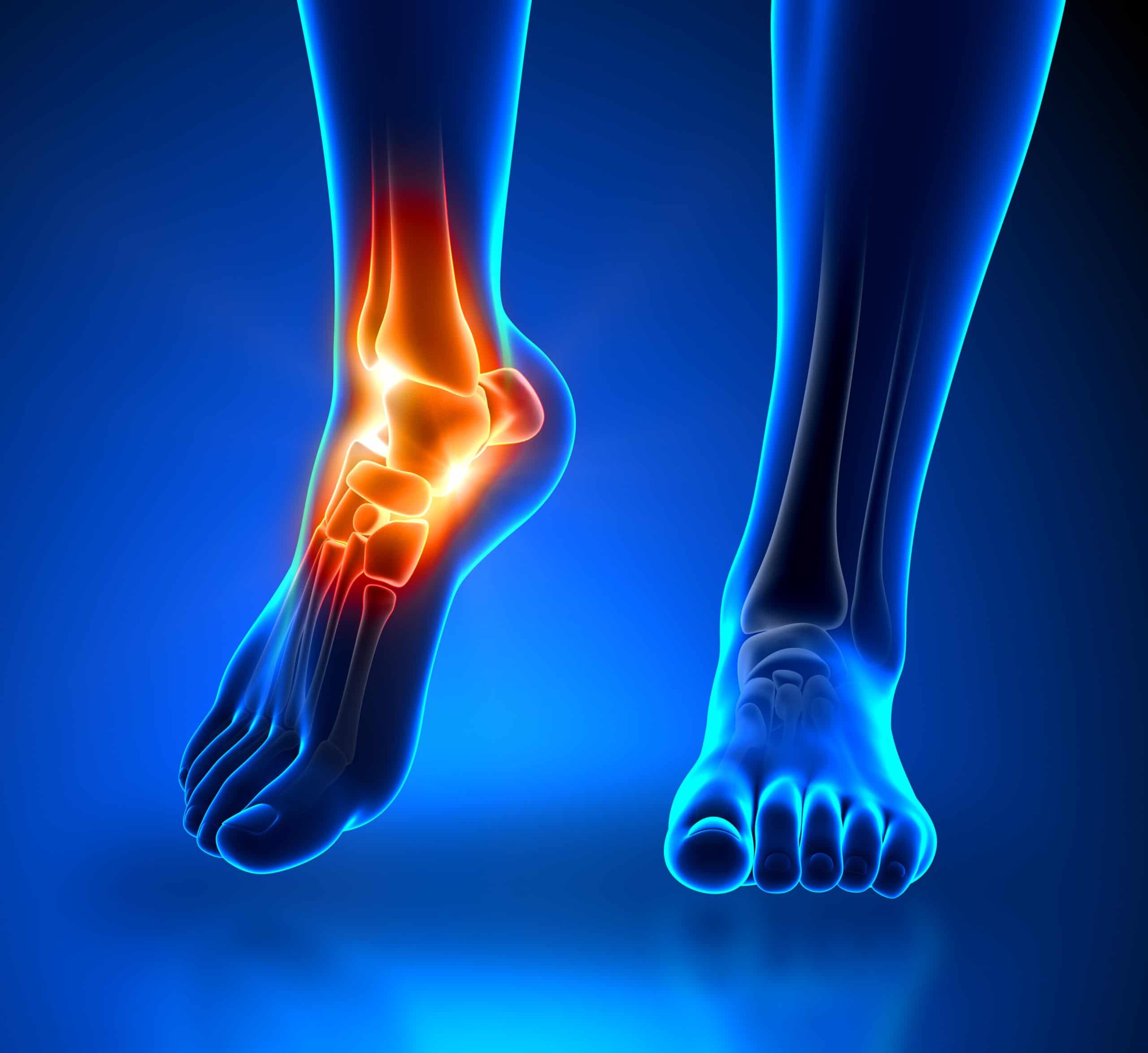 Foot And Ankle Pain: Causes, Treatments, And Prevention